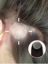2 "* 2" Capelli Umani A Base Di Pelle Completa Coprono Le Toppe Dei Capelli Nessuna Soluzione Chirurgica Per L'Alopecia Areata