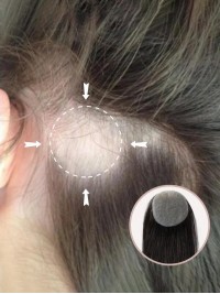 2 "* 2" Capelli Umani A Base Di Pelle Completa Coprono Le Toppe Dei Capelli Nessuna Soluzione Chirurgica Per L'Alopecia Areata