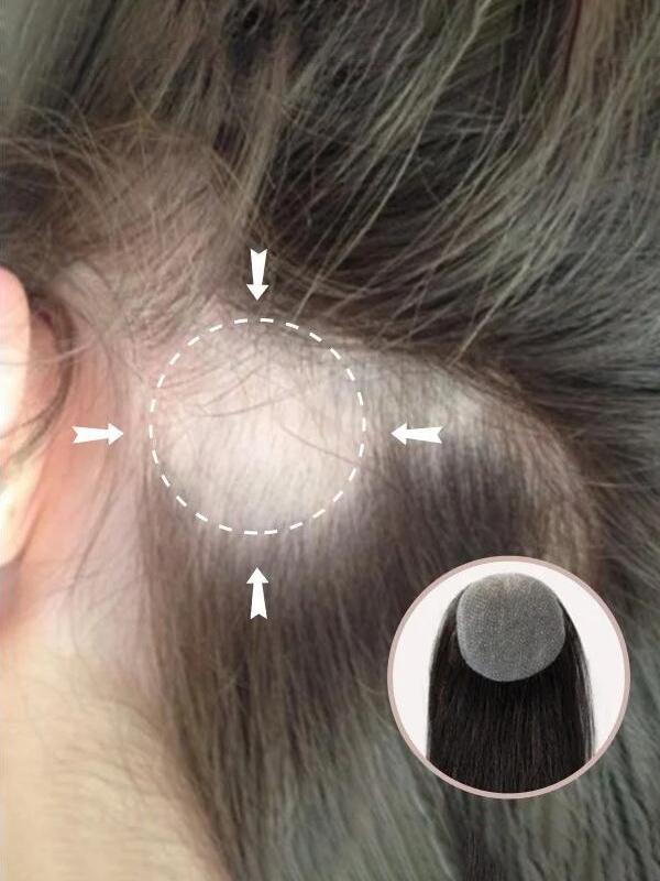 2 "* 2" Capelli Umani A Base Di Pelle Completa Coprono Le Toppe Dei Capelli Nessuna Soluzione Chirurgica Per L'Alopecia Areata