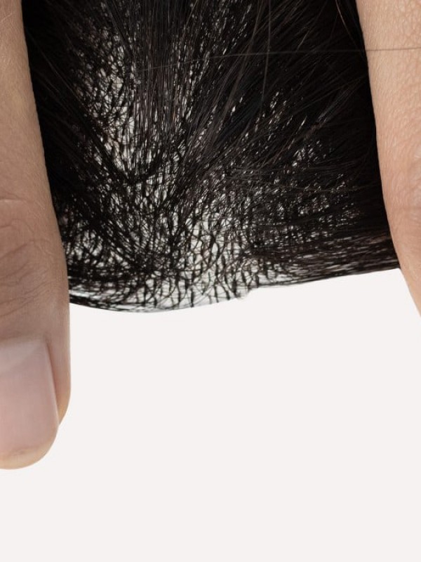 2 "* 2" Capelli Umani A Base Di Pelle Completa Coprono Le Toppe Dei Capelli Nessuna Soluzione Chirurgica Per L'Alopecia Areata